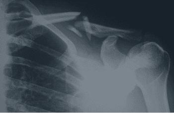 Trauma & Fracture Care