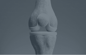 Joint Replacement